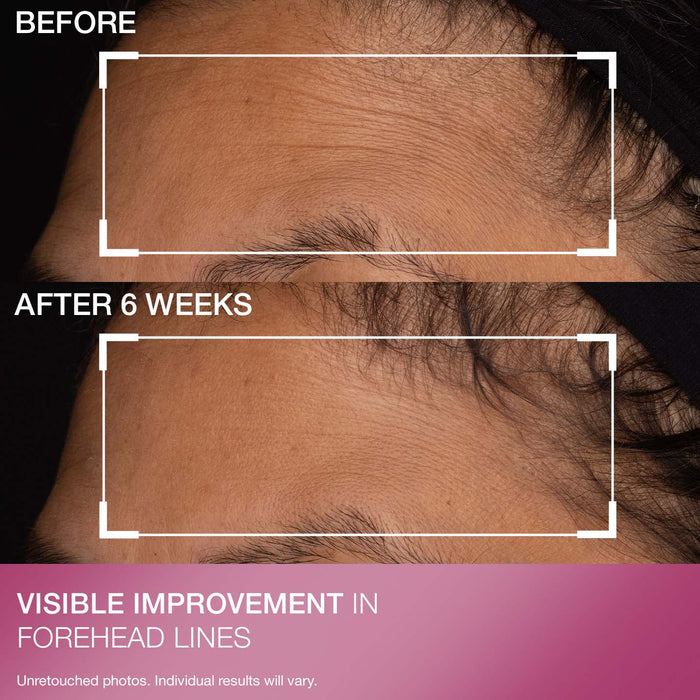 Advanced Retinol Daily Repair Moisturizer Broad Spectrum SPF 30