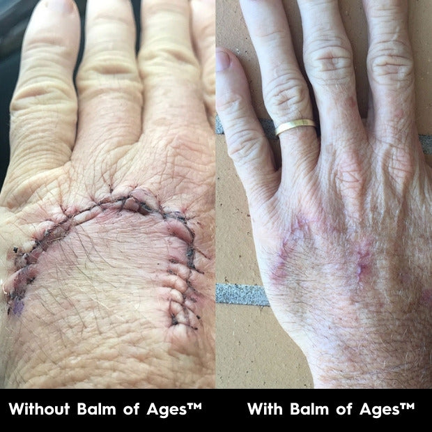 Balm of Ages Mini, a portable organic body balm for skin