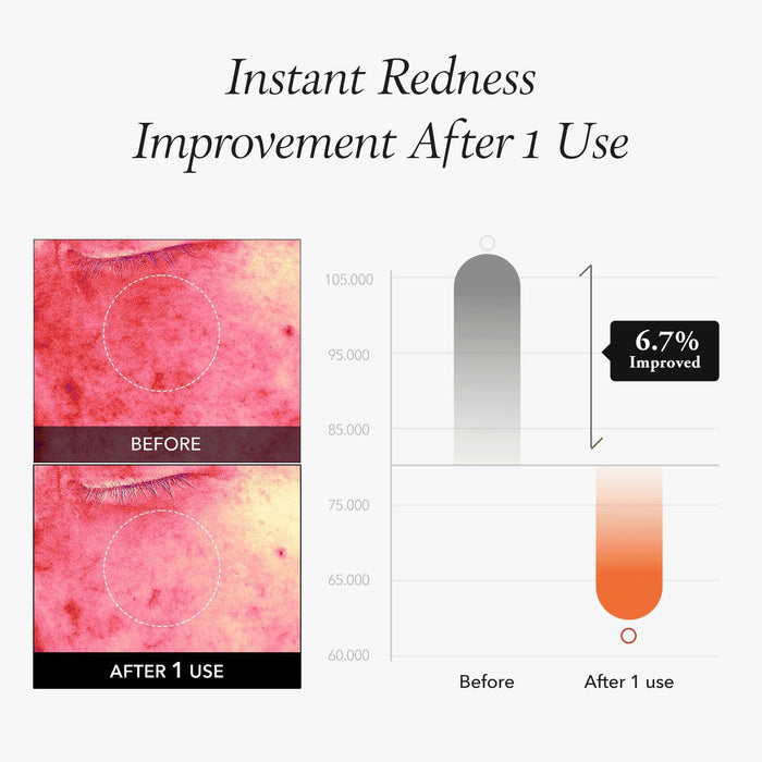 APRILSKIN Carrotenee IPMP Instant Calming Serum Pads 80 pads