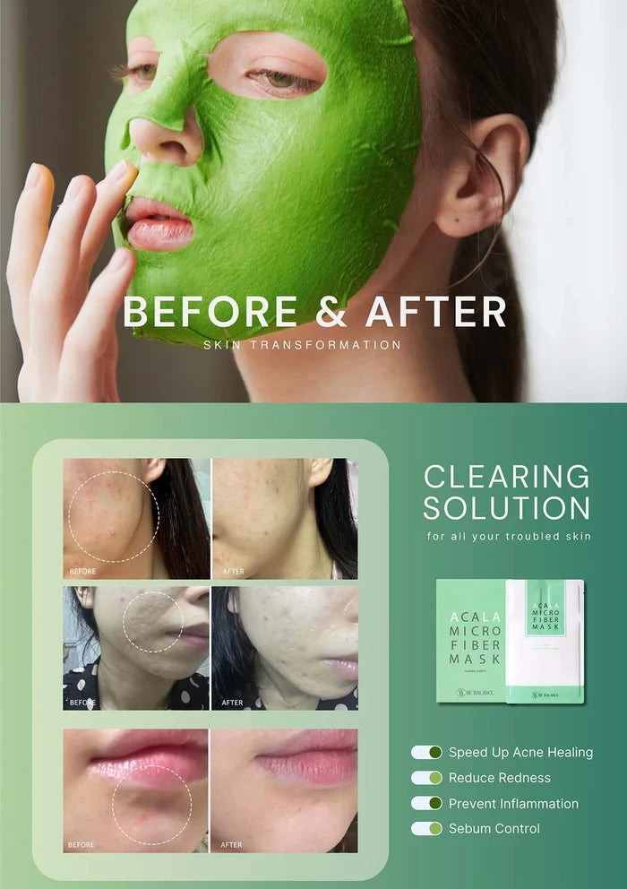 Before and after skin transformation with a green facial mask and product packaging.