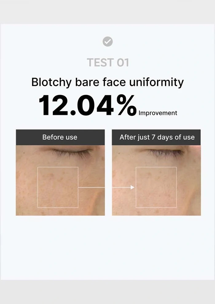 Before and after skin improvement test showing 12.04% reduction in blotchy bare face uniformity.