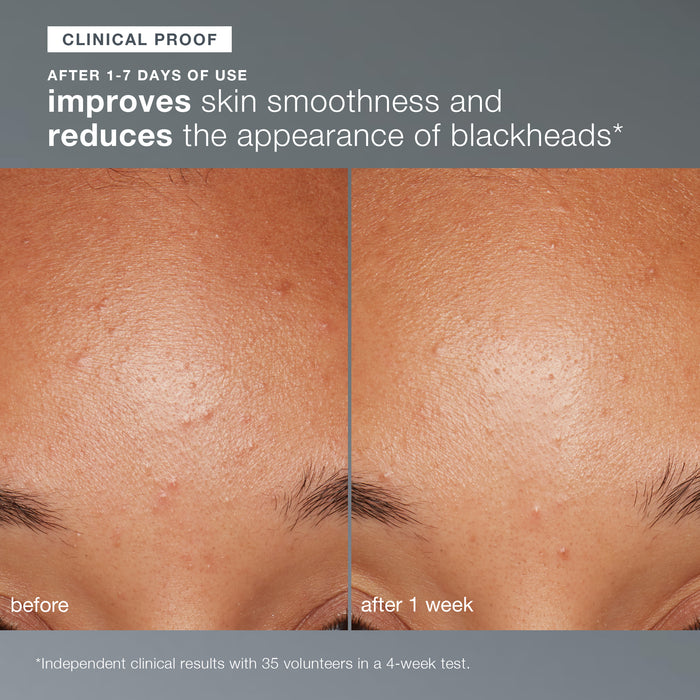 daily microfoliant exfoliator