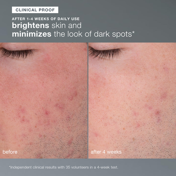 daily microfoliant exfoliator