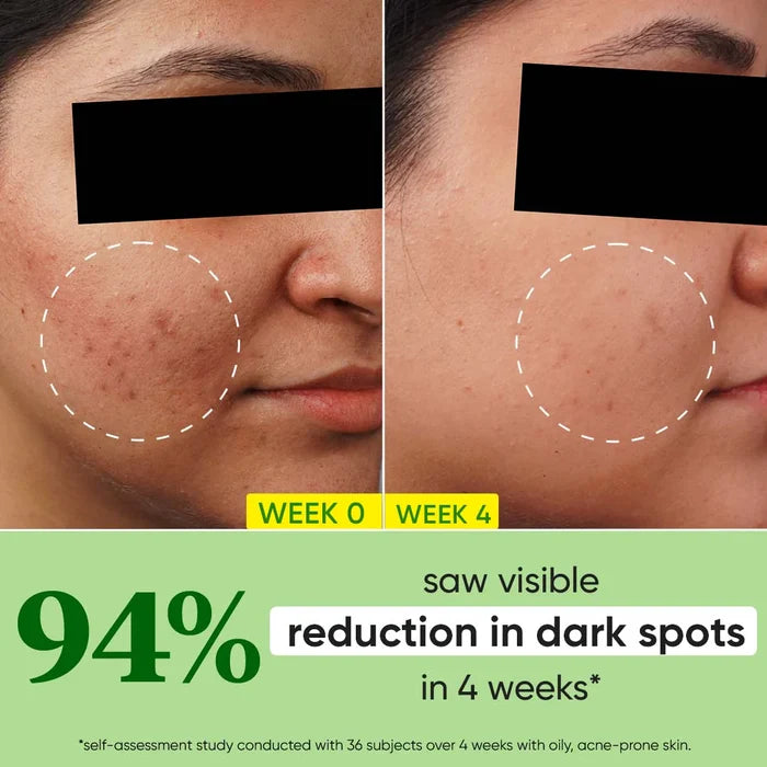 Dot and Key Cica + 10% Niacinamide Spot Reduction Face Serum 30ml