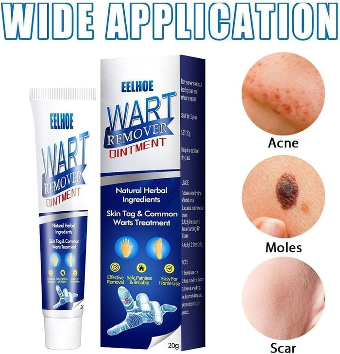 EELHOE Wart Remover Ointment with natural herbal ingredients for skin tag, warts, acne, moles, and scars treatment
