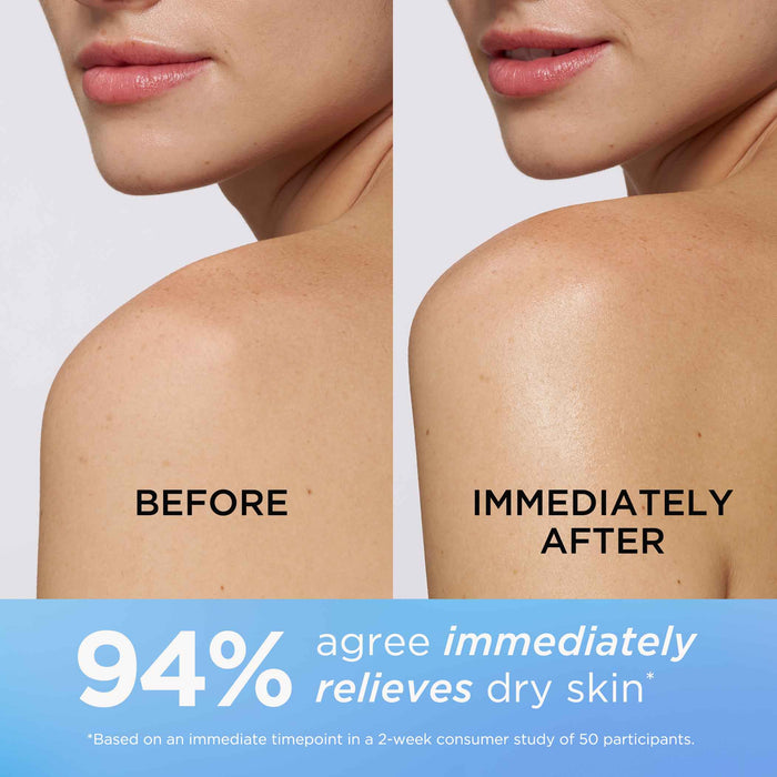 Before and Immediately after. 94% agree immediately relieves dry skin* *Based on an immediate timepoint in a 2-week consumer study of 50 participants