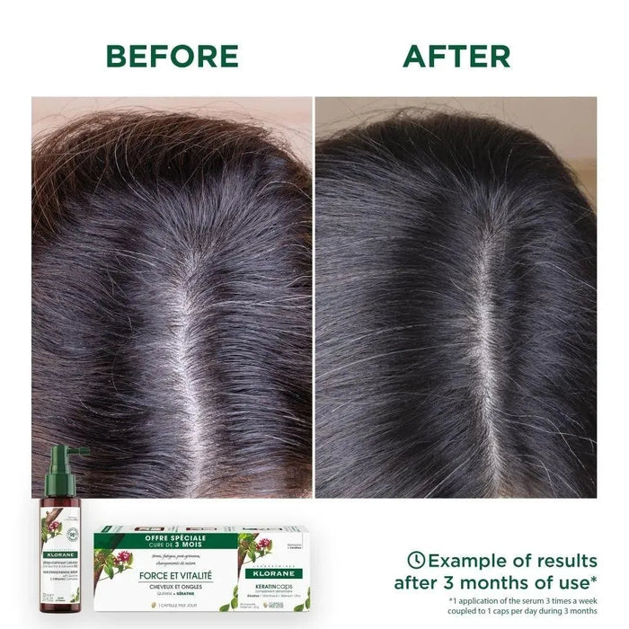 Klorane anti-hair loss treatment - Hairgivers