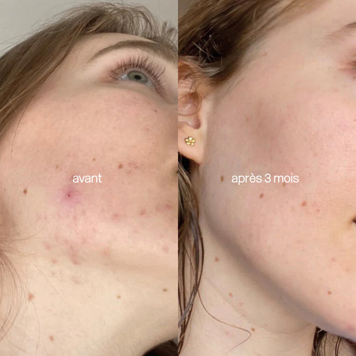 L'Essentiel Peau Cure de 3 mois