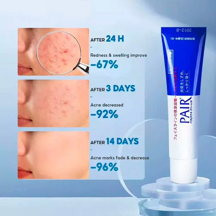 Lion Pair Acne Cream W 0.49oz/ 14g