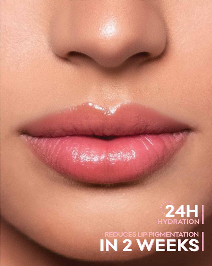 Picture of a girl's lips wearing slight tint of a lip balm
