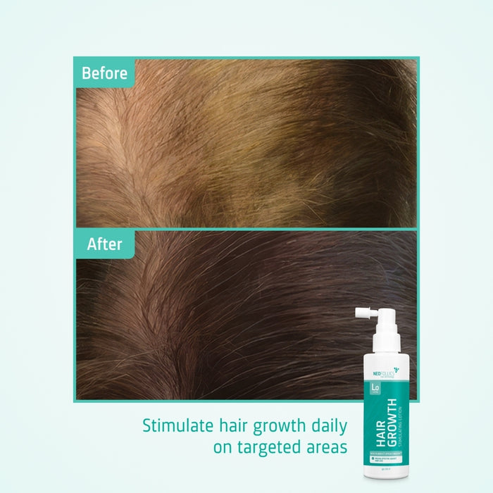 Neofollics hair growth lotion (7% Neoxyl)