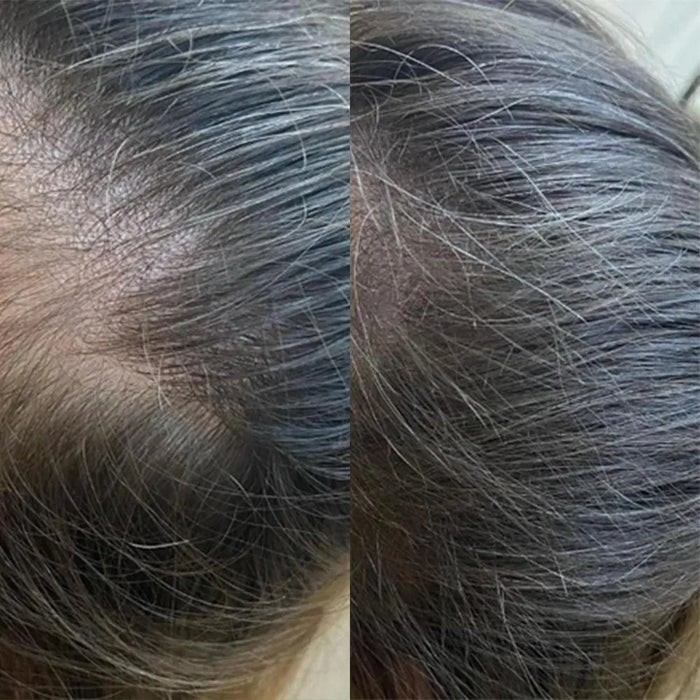 Panthrix hair growth serum 3-pack (Redensyl) - Hairgivers