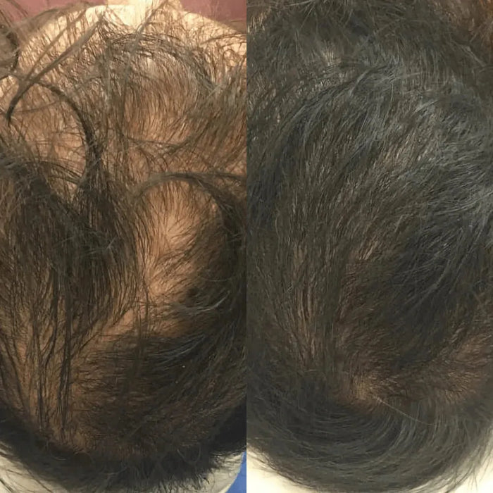 Revita hair growth shampoo + conditioner (205 ml) - Hairgivers