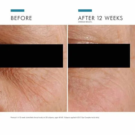 SkinCeuticals A.G.E Advanced Eye Complex 15ml