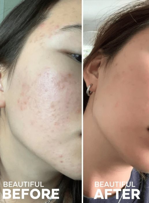 Three Ships Purify Aloe + Amino Acid Gel Cleanser - Aesthetics By Kell
