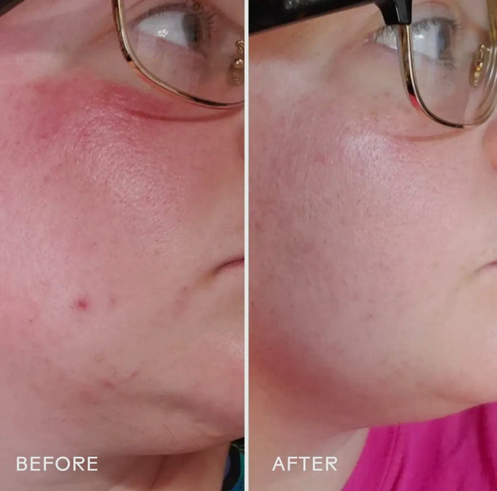 Three Ships Radiance Grape Stem Cell + Squalane Day Cream - Aesthetics By Kell