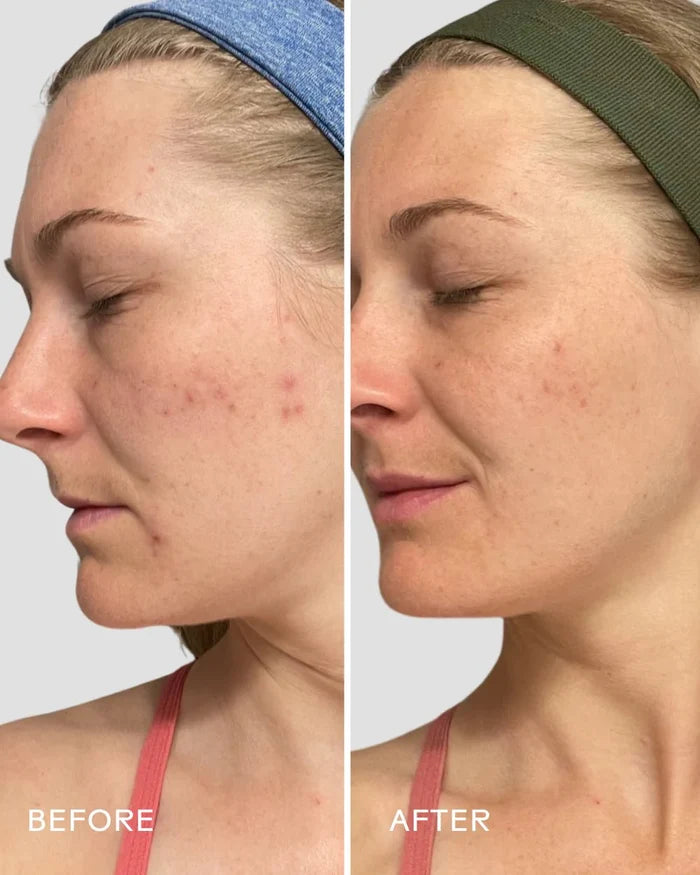 Three Ships Refresh Papaya + Salicylic Acid Foaming Cleanser - Aesthetics By Kell